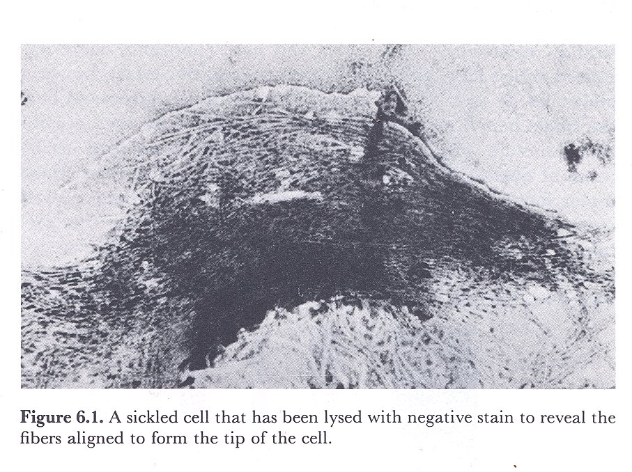 Picture of Sickle Cell Anemic Red Blood Cell with rod like formations, Edelstein, 1986: p 117